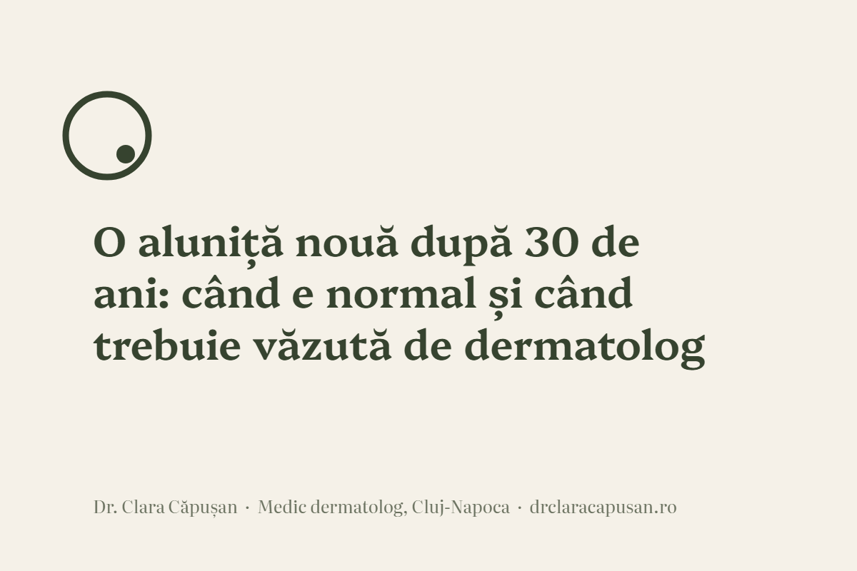 O aluniță nouă după 30 de ani: când e normal și când trebuie văzută de dermatolog