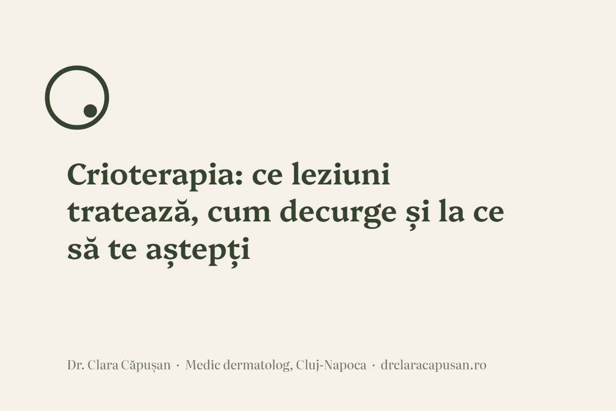 Crioterapia: ce leziuni tratează, cum decurge și la ce să te aștepți